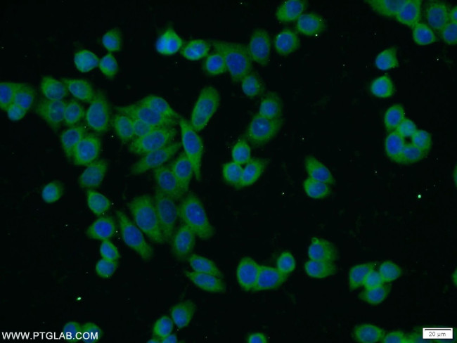 IKBKG Antibody in Immunocytochemistry (ICC/IF)