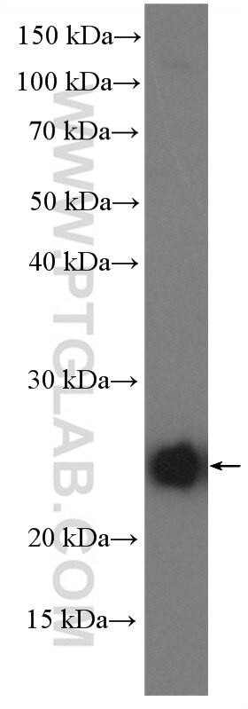 POLR2G Antibody in Western Blot (WB)