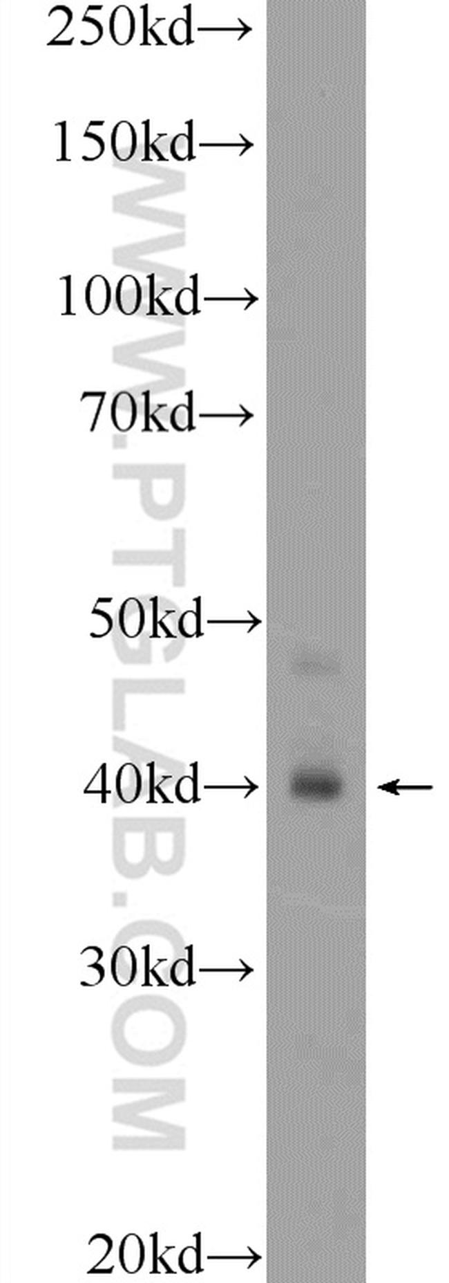 HOXA9 Antibody in Western Blot (WB)