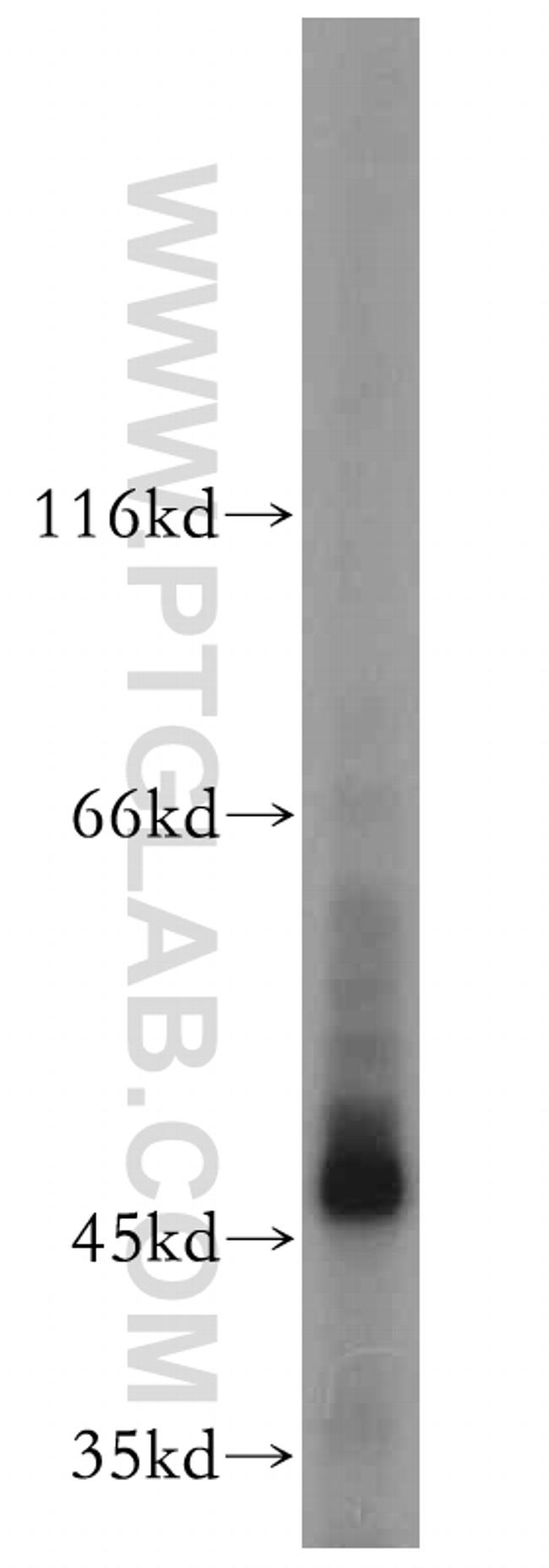 GAL3ST1 Antibody in Western Blot (WB)