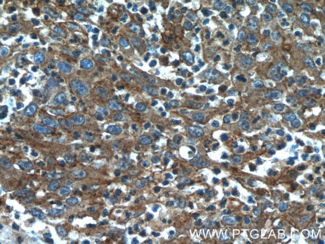 CYP1B1 Antibody in Immunohistochemistry (Paraffin) (IHC (P))