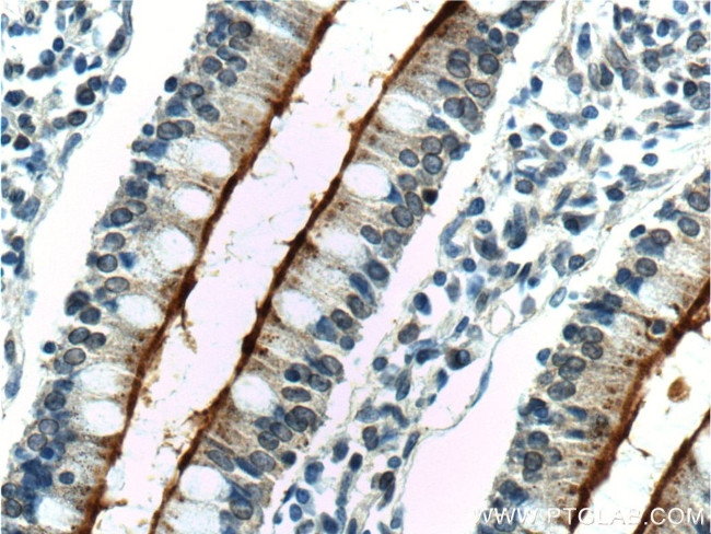 ALPPL2 Antibody in Immunohistochemistry (Paraffin) (IHC (P))