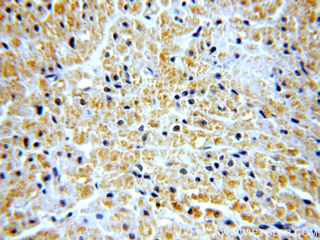 SH2D2A Antibody in Immunohistochemistry (Paraffin) (IHC (P))