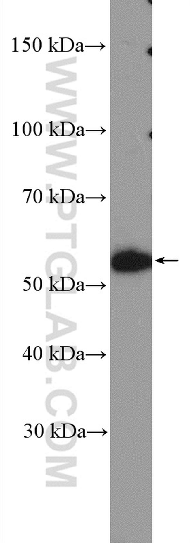 NAB1 Antibody in Western Blot (WB)