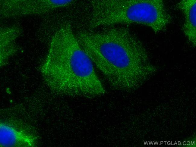 PDLIM4 Antibody in Immunocytochemistry (ICC/IF)