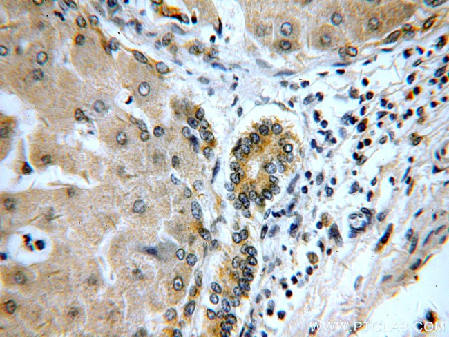 DTX2 Antibody in Immunohistochemistry (Paraffin) (IHC (P))