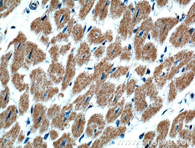 GBAS Antibody in Immunohistochemistry (Paraffin) (IHC (P))