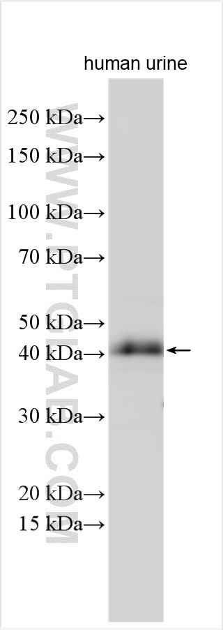 QPCT Antibody in Western Blot (WB)