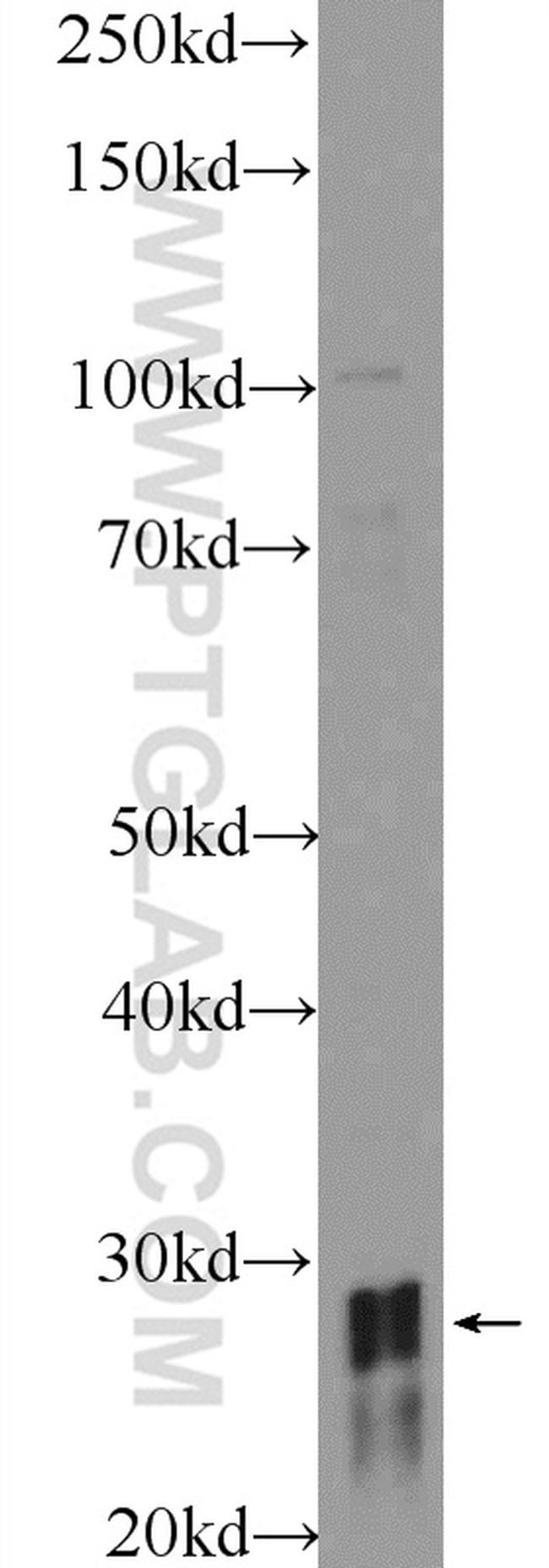 HOXD8 Antibody in Western Blot (WB)