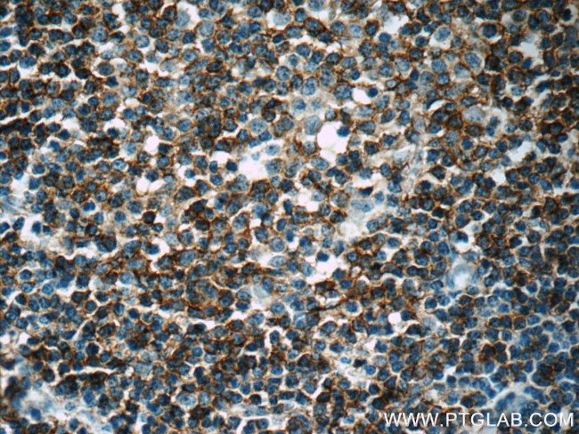CD23 Antibody in Immunohistochemistry (Paraffin) (IHC (P))