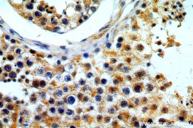FUT10 Antibody in Immunohistochemistry (Paraffin) (IHC (P))