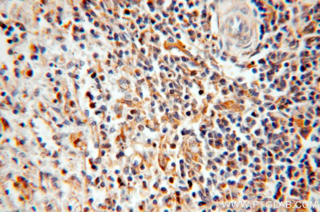 TSPAN7 Antibody in Immunohistochemistry (Paraffin) (IHC (P))