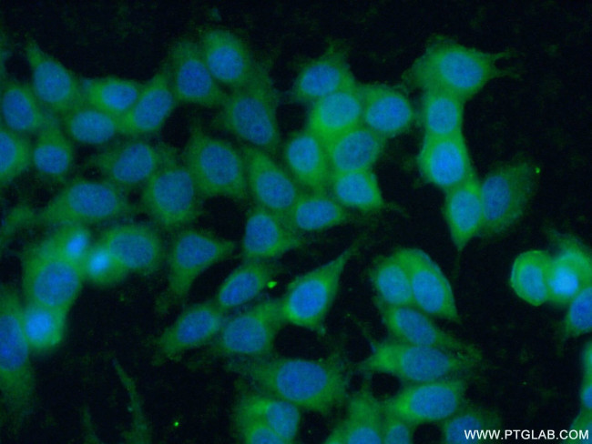 c-Kit/CD117 Antibody in Immunocytochemistry (ICC/IF)