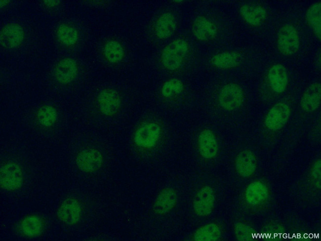 SRA1 Antibody in Immunocytochemistry (ICC/IF)