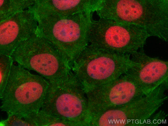 ZBTB7A Antibody in Immunocytochemistry (ICC/IF)
