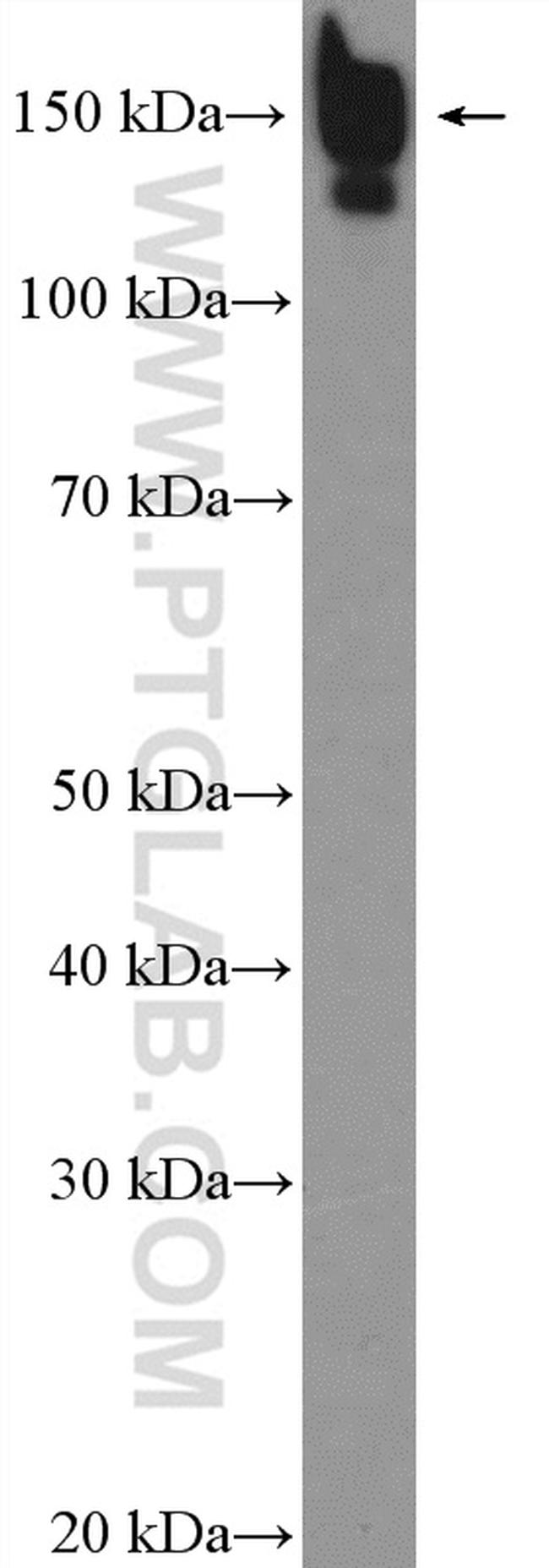 CPS1 Antibody in Western Blot (WB)