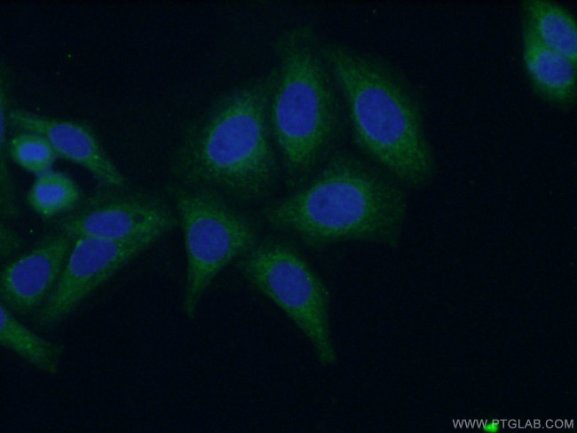 Cytokeratin 18 Antibody in Immunocytochemistry (ICC/IF)