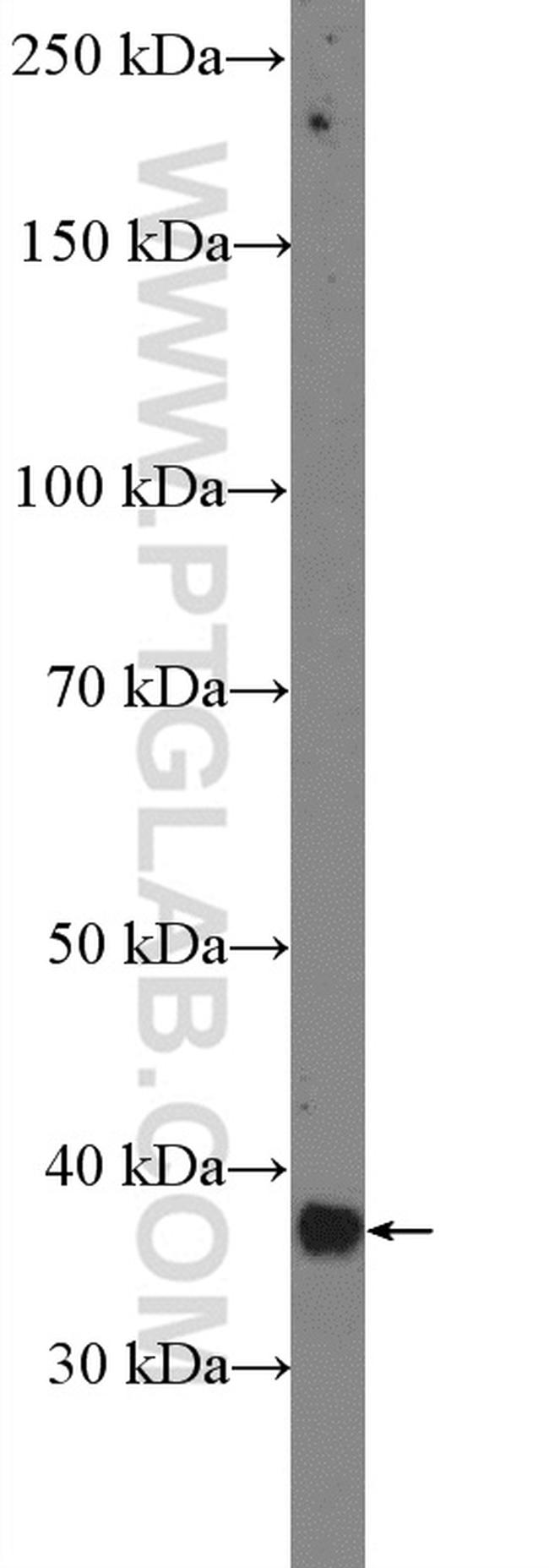 MEF2B Antibody in Western Blot (WB)