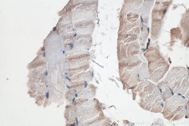SPEG Antibody in Immunohistochemistry (Paraffin) (IHC (P))