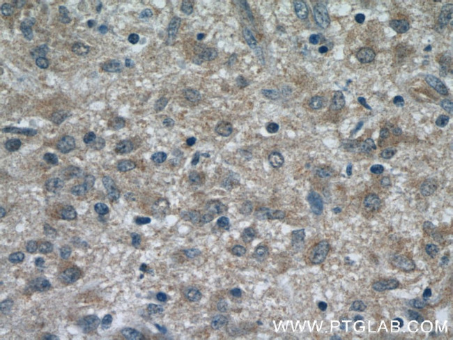 RAB9A Antibody in Immunohistochemistry (Paraffin) (IHC (P))