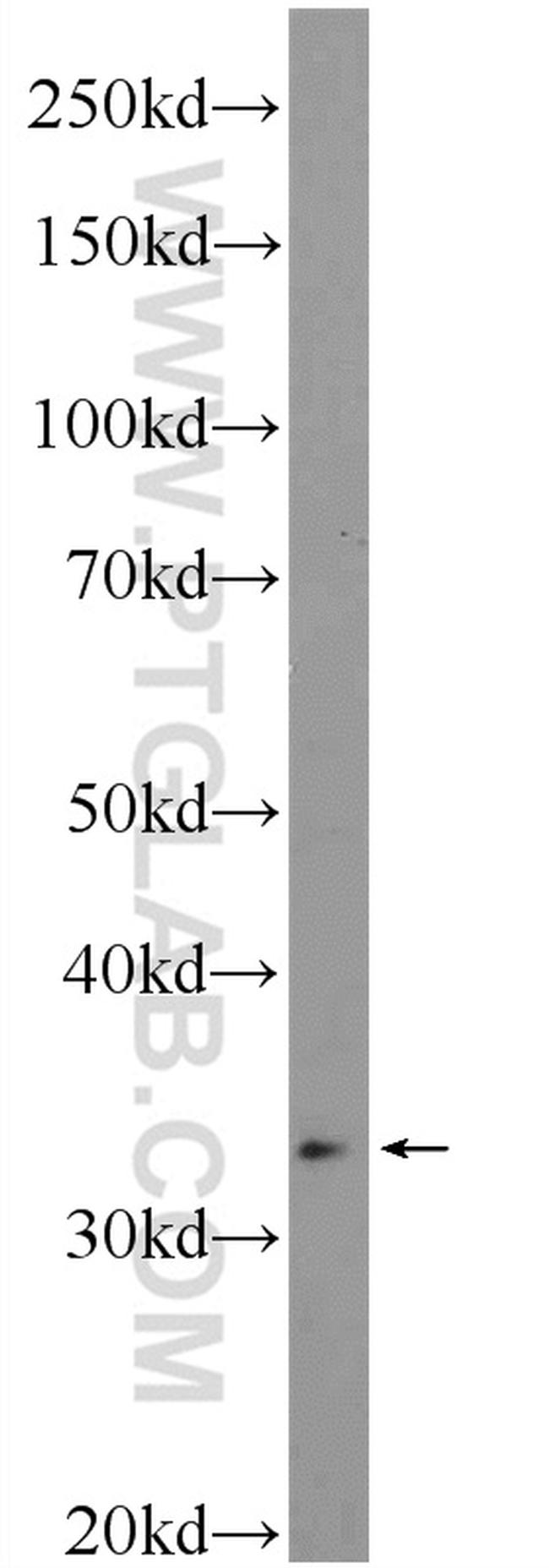 HOXD11 Antibody in Western Blot (WB)