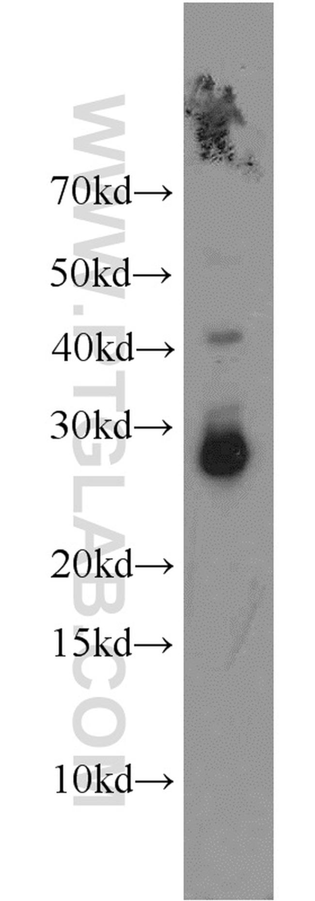 HOXD12 Antibody in Western Blot (WB)