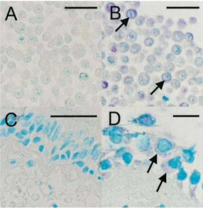 Rhinovirus 16 Antibody in Immunohistochemistry (IHC)