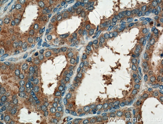 GNMT Antibody in Immunohistochemistry (Paraffin) (IHC (P))