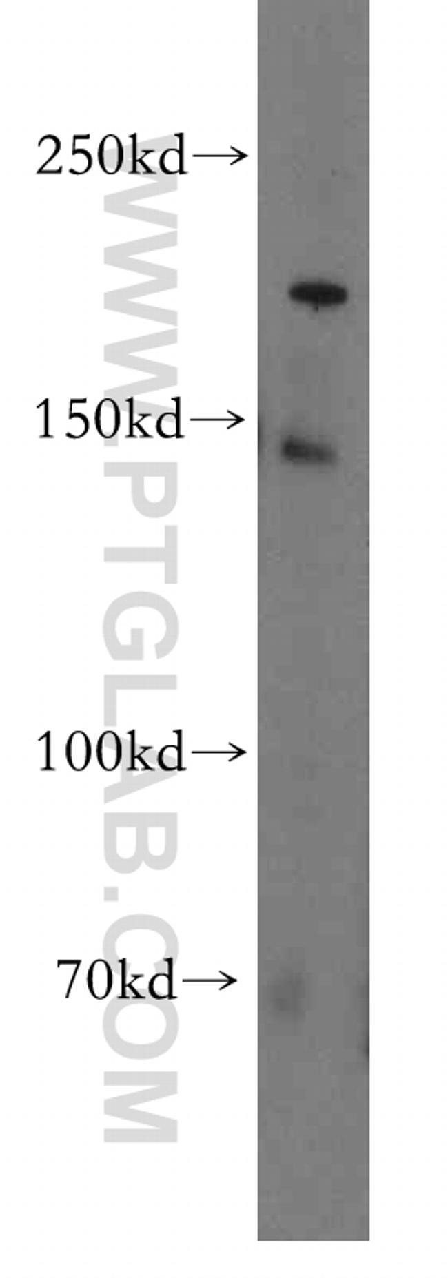 PDS5B Antibody in Western Blot (WB)