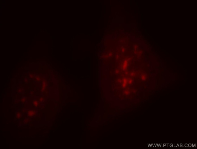INTS8 Antibody in Immunocytochemistry (ICC/IF)