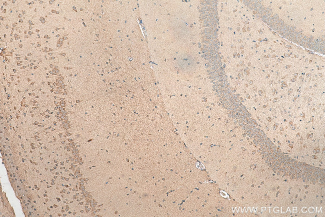 PCDHA3 Antibody in Immunohistochemistry (Paraffin) (IHC (P))