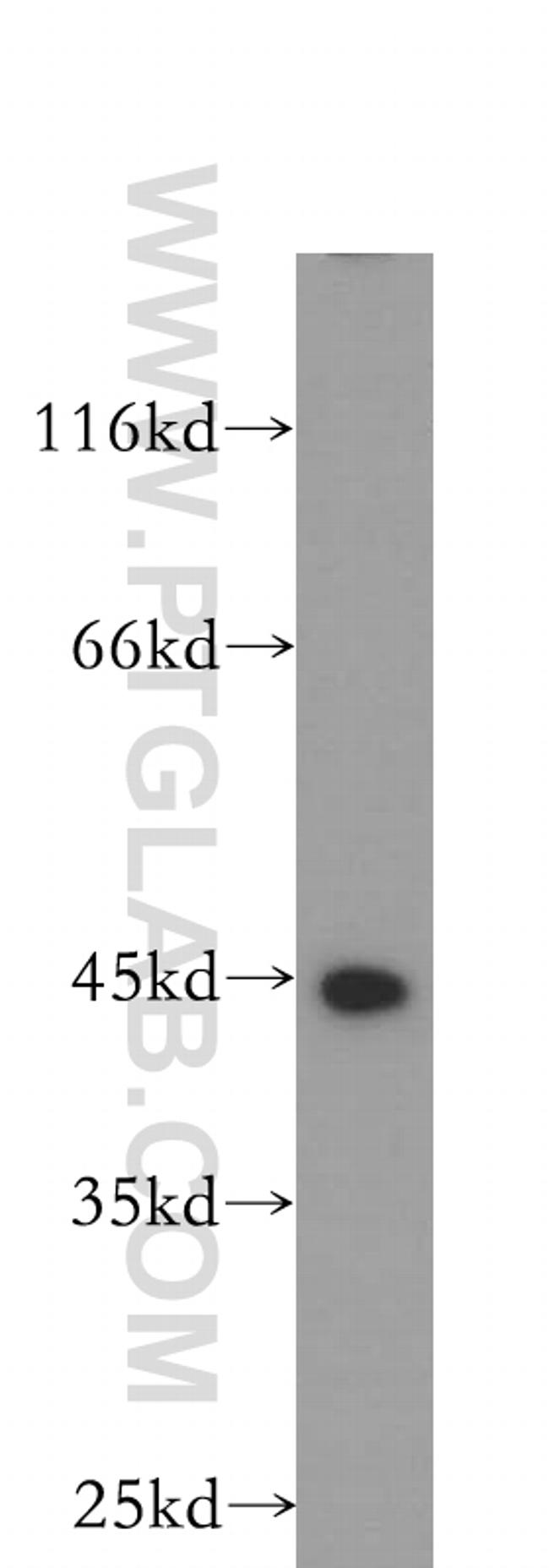 MEPE Antibody in Western Blot (WB)