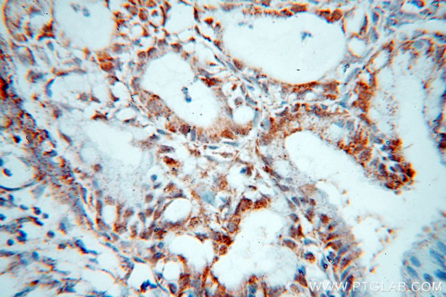 GCHFR Antibody in Immunohistochemistry (Paraffin) (IHC (P))