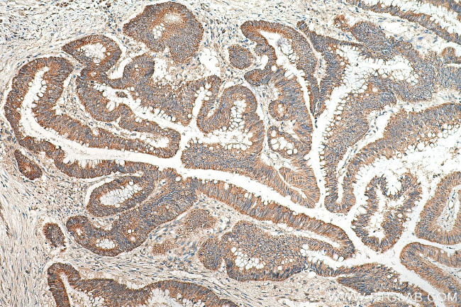 INO80 Antibody in Immunohistochemistry (Paraffin) (IHC (P))