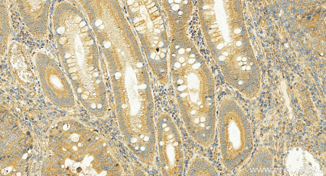 ITLN2 Antibody in Immunohistochemistry (Paraffin) (IHC (P))