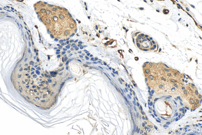 LIPM Antibody in Immunohistochemistry (Paraffin) (IHC (P))