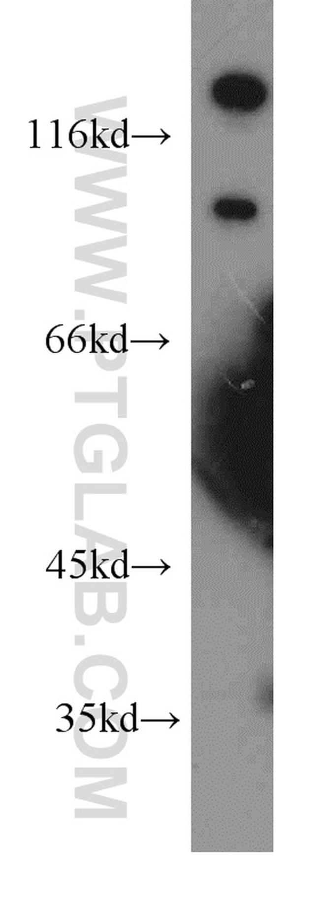 OTOP3 Antibody in Western Blot (WB)