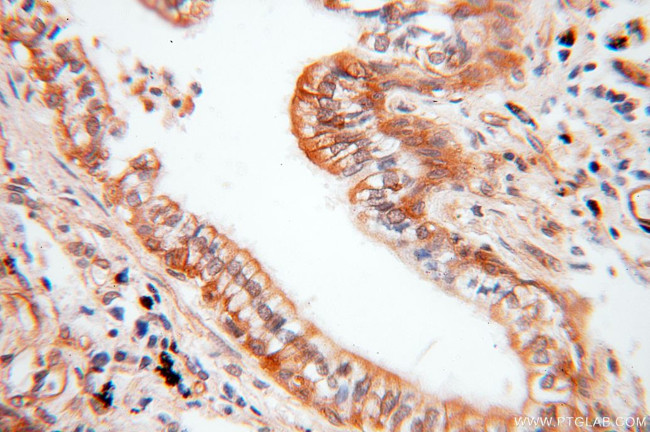 CCNI2 Antibody in Immunohistochemistry (Paraffin) (IHC (P))