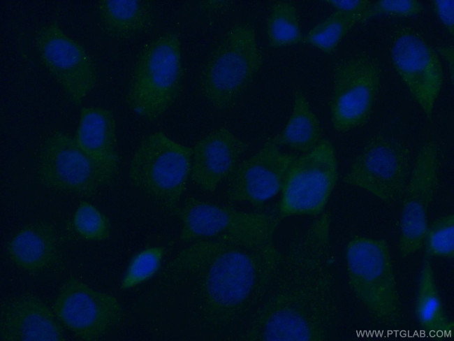 MYO16 Antibody in Immunocytochemistry (ICC/IF)
