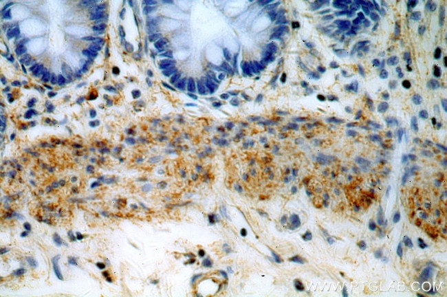 HMCN1 Antibody in Immunohistochemistry (Paraffin) (IHC (P))