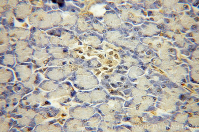 USP32 Antibody in Immunohistochemistry (Paraffin) (IHC (P))