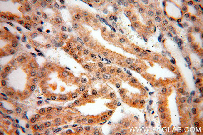 CIB4 Antibody in Immunohistochemistry (Paraffin) (IHC (P))