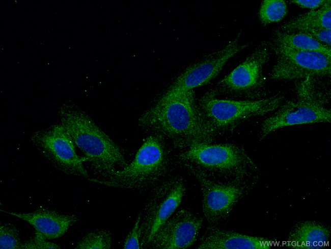 DNAH2 Antibody in Immunocytochemistry (ICC/IF)