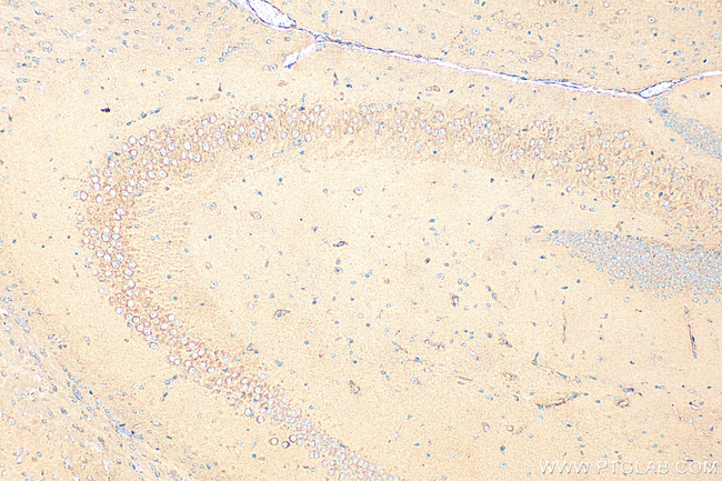 LPPR5 Antibody in Immunohistochemistry (Paraffin) (IHC (P))