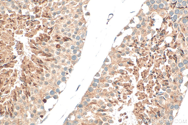 GGNBP1 Antibody in Immunohistochemistry (Paraffin) (IHC (P))
