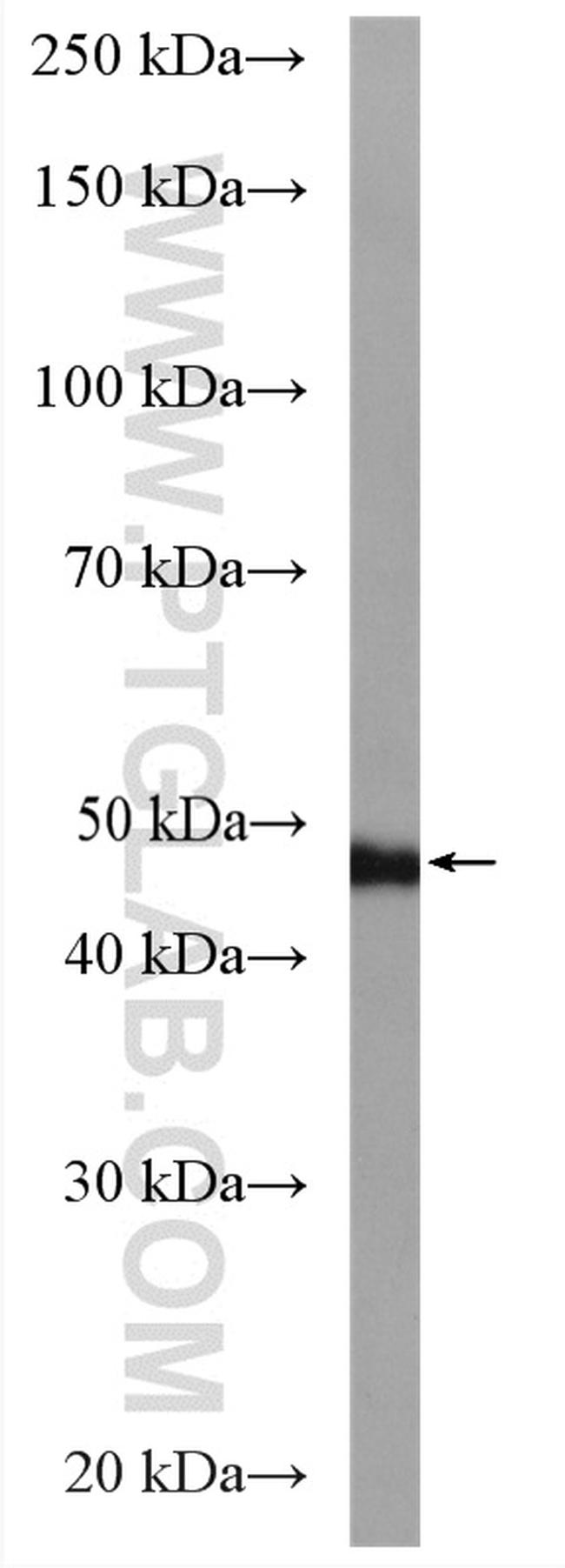 DYNC1LI2 Antibody in Western Blot (WB)