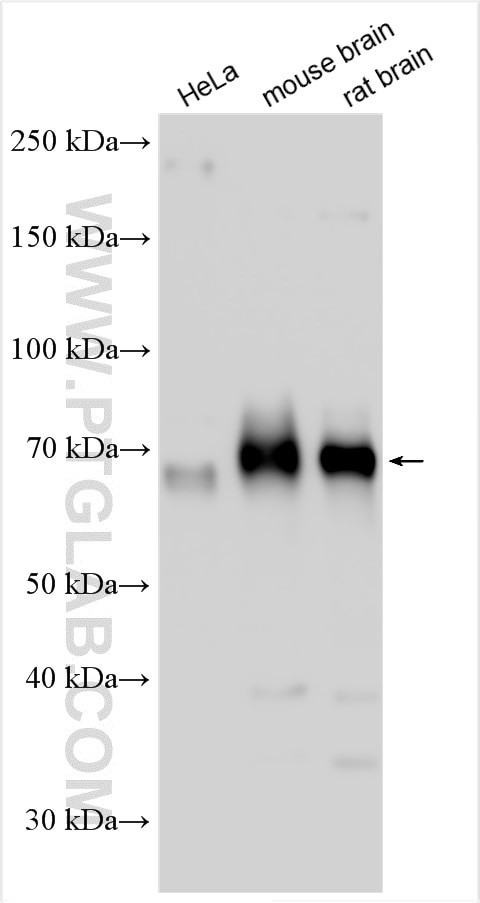PALM2 Antibody in Western Blot (WB)