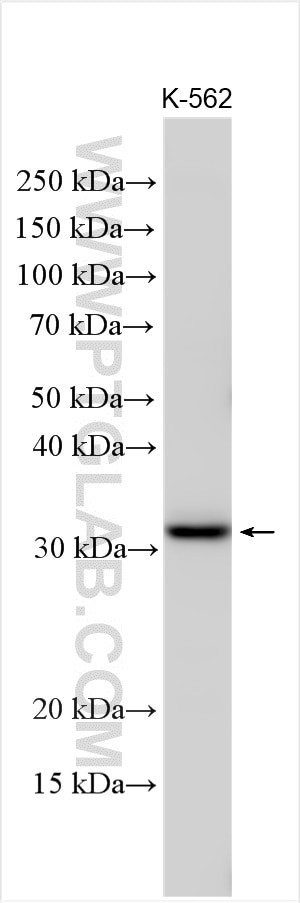 HOXB9 Antibody in Western Blot (WB)