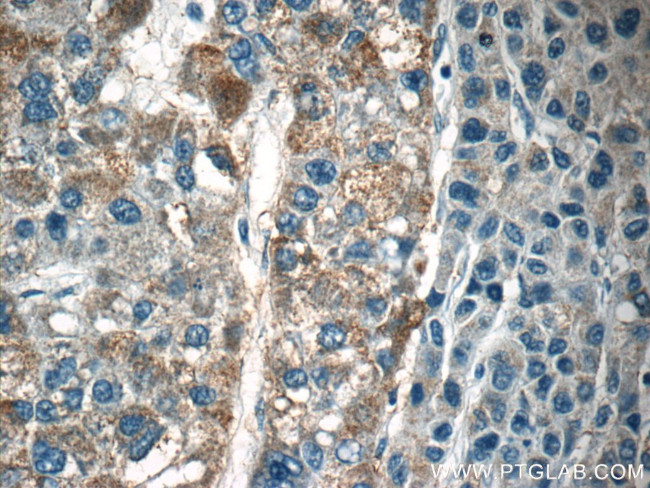 LAPTM4B Antibody in Immunohistochemistry (Paraffin) (IHC (P))