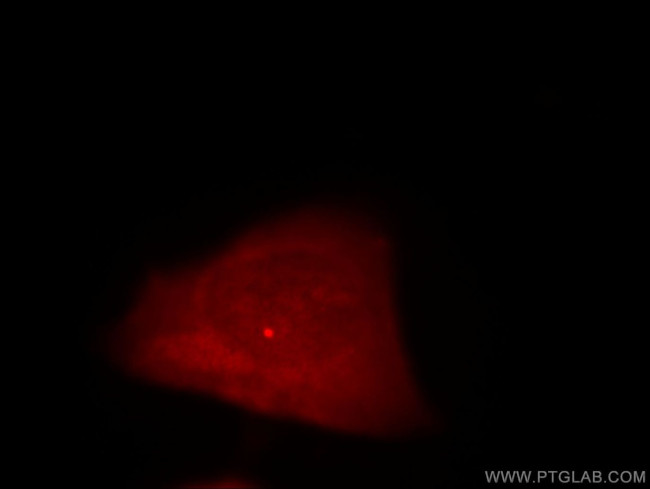 CEP170/CEP170L Antibody in Immunocytochemistry (ICC/IF)